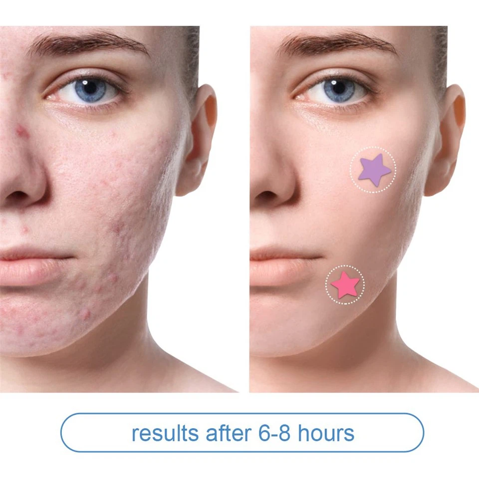 Colorful Star Pimple Patches Hydrocolloid Acne Patch With Salicylic Acid & Tea Tree Oil